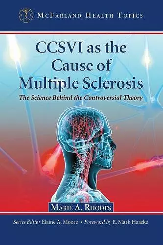 CCSVI as the Cause of Multiple Sclerosis cover