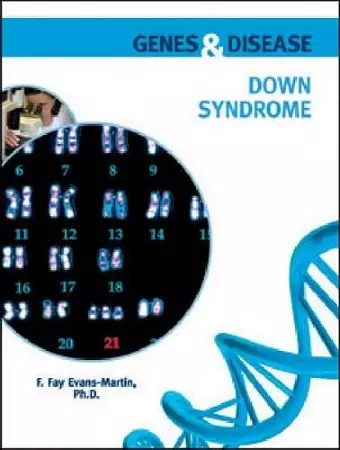 Down Syndrome cover