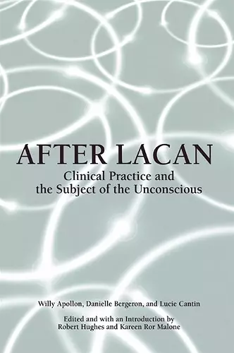 After Lacan cover