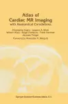 Atlas of Cardiac Nuclear Magnetic Resonance with Anatomical Correlations cover