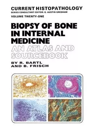 Biopsy of Bone in Internal Medicine cover