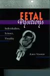 Fetal Positions cover