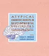 Atypical Cognitive Deficits in Developmental Disorders cover