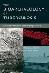 The Bioarchaeology of Tuberculosis cover