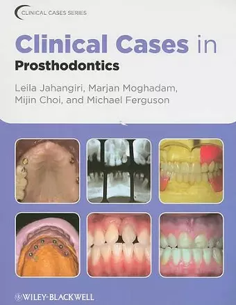 Clinical Cases in Prosthodontics cover