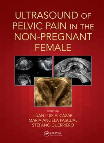 Ultrasound of Pelvic Pain in the Non-Pregnant Patient cover