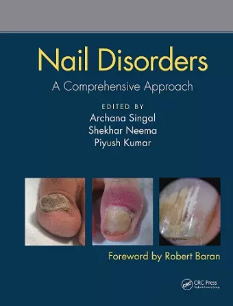 Nail Disorders cover