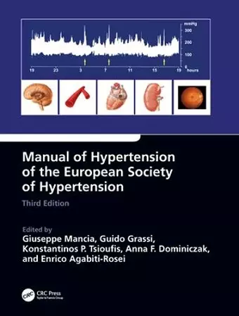 Manual of Hypertension of the European Society of Hypertension, Third Edition cover