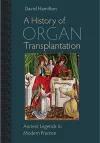 A History of Organ Transplantation cover