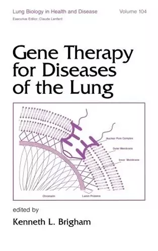 Gene Therapy for Diseases of the Lung cover