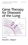 Gene Therapy for Diseases of the Lung cover