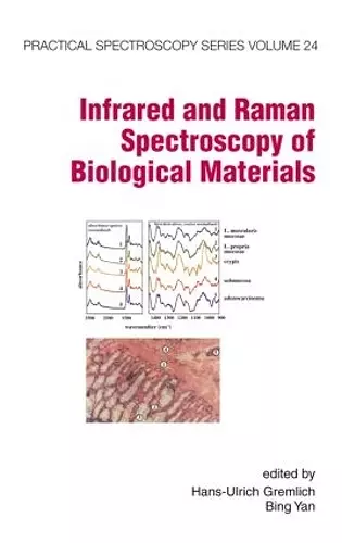 Infrared and Raman Spectroscopy of Biological Materials cover