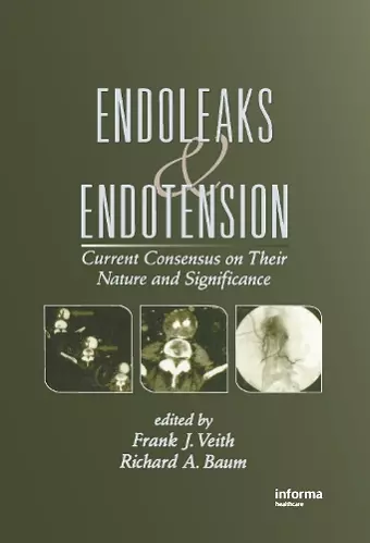 Endoleaks and Endotension cover