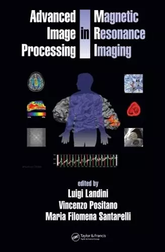 Advanced Image Processing in Magnetic Resonance Imaging cover