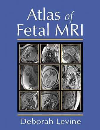 Atlas of Fetal MRI cover