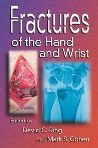 Fractures of the Hand and Wrist cover