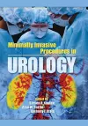 Minimally Invasive Procedures in Urology cover