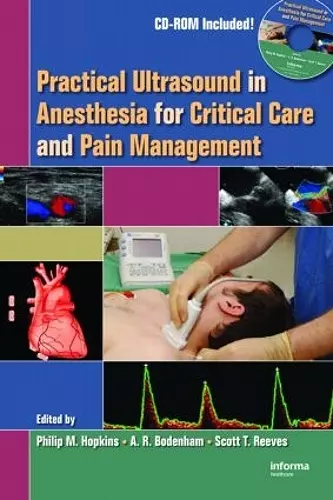 Practical Ultrasound in Anesthesia for Critical Care and Pain Management cover