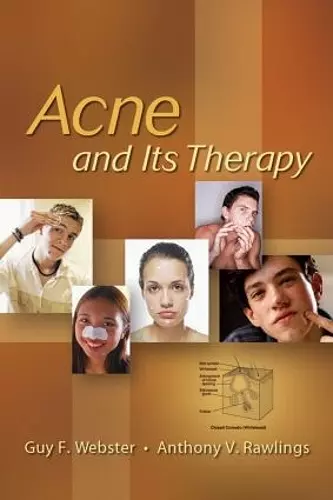 Acne and Its Therapy cover