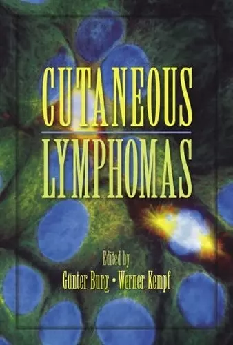 Cutaneous Lymphomas cover