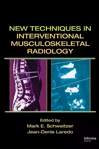 New Techniques in Interventional Musculoskeletal Radiology cover