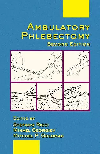 Ambulatory Phlebectomy cover