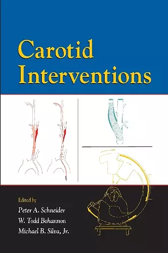 Carotid Interventions cover