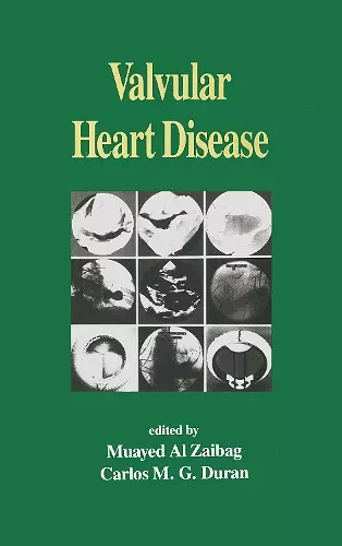 Valvular Heart Disease cover