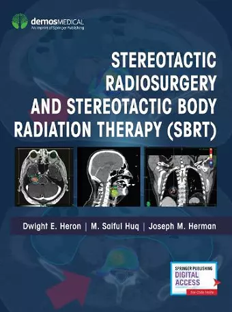 Stereotactic Radiosurgery and Stereotactic Body Radiation Therapy (SBRT) cover