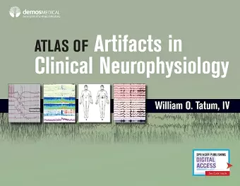 Atlas of Artifacts in Clinical Neurophysiology cover