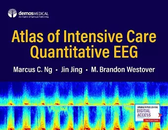 Atlas of Intensive Care Quantitative EEG cover