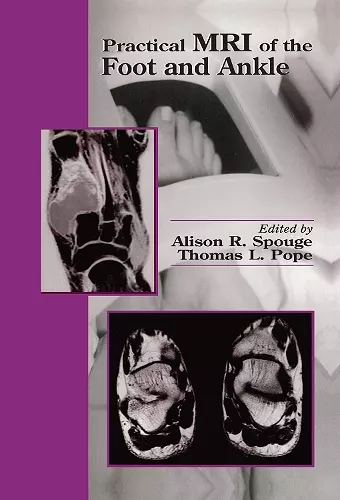 Practical MRI of the Foot and Ankle cover