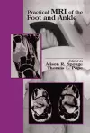 Practical MRI of the Foot and Ankle cover