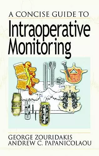 A Concise Guide to Intraoperative Monitoring cover