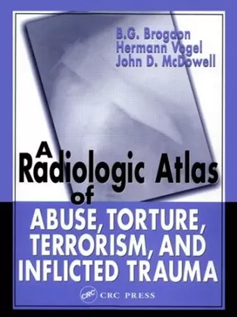 A Radiologic Atlas of Abuse, Torture, Terrorism, and Inflicted Trauma cover