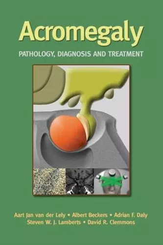 Acromegaly cover
