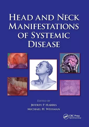 Head and Neck Manifestations of Systemic Disease cover