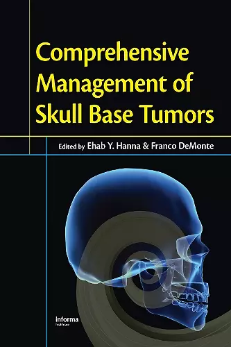 Comprehensive Management of Skull Base Tumors cover