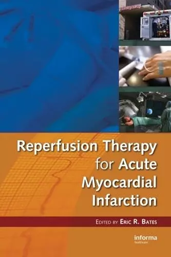 Reperfusion Therapy for Acute Myocardial Infarction cover