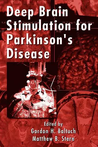 Deep Brain Stimulation for Parkinson's Disease cover