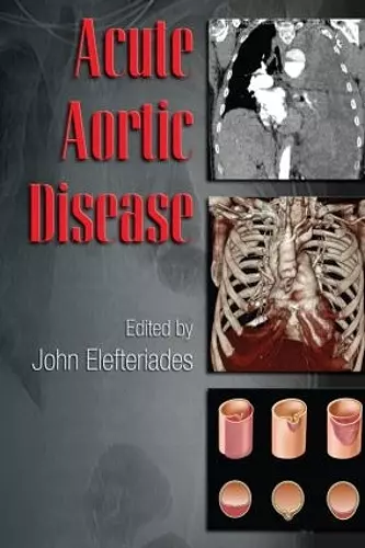 Acute Aortic Disease cover