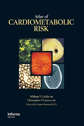 Atlas of Cardiometabolic Risk cover