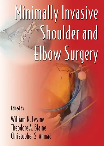 Minimally Invasive Shoulder and Elbow Surgery cover