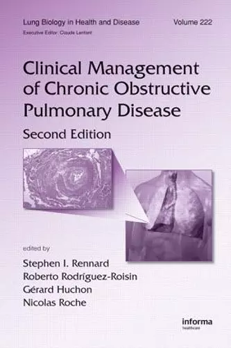 Clinical Management of Chronic Obstructive Pulmonary Disease cover