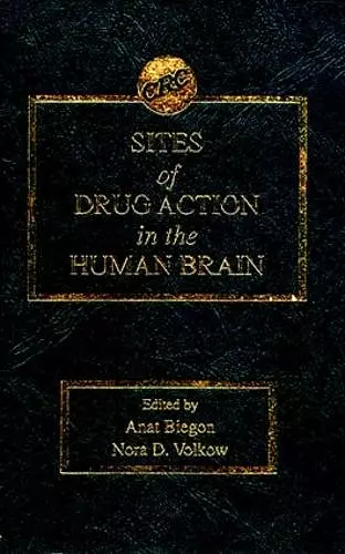 Sites of Drug Action in the Human Brain cover