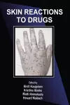 Skin Reactions to Drugs cover