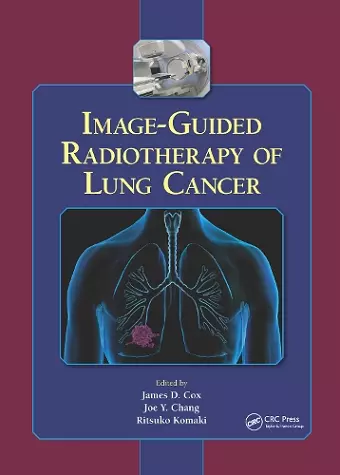 Image-Guided Radiotherapy of Lung Cancer cover