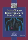 Image-Guided Radiotherapy of Lung Cancer cover