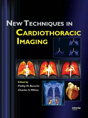 New Techniques in Cardiothoracic Imaging cover