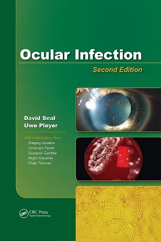 Ocular Infection cover